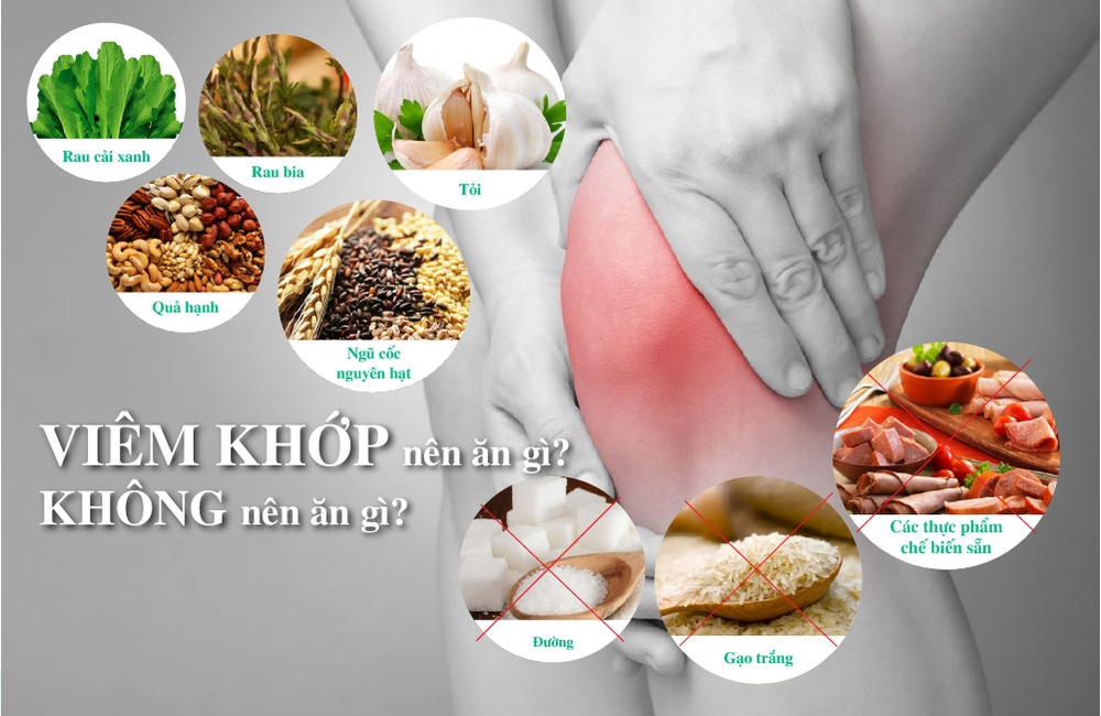 Bệnh viêm khớp nên ăn gì?kiêng ăn gì?bớt đau, giảm viêm, nhanh khỏi?