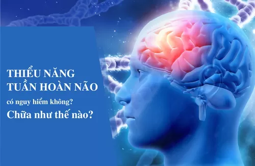 Thiểu năng tuần hoàn não có nguy hiểm không?chữa như thế nào?