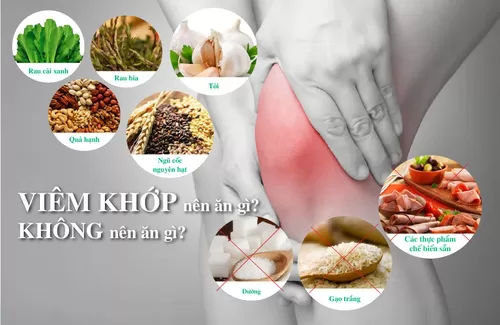 Bệnh viêm khớp nên ăn gì?kiêng ăn gì?bớt đau, giảm viêm, nhanh khỏi?
